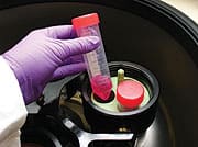 Master Regulators of Joint Repair