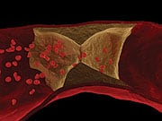 Enhanced Protection Against Atherosclerosis