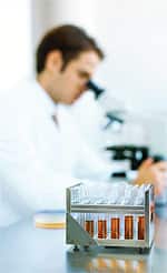 Erroneous Regulation of DHEA and Pregnenolone