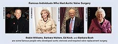 Famous Individuals Who Had Aortic Valve Surrery