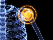 Rapid Relief from Joint Pain