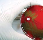 The EMF fills a gap, Advances Science