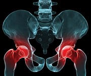 Twelve Correctable Causes of Osteoarthritis