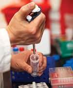 Apple Polyphenols’ Unique Fat Management 