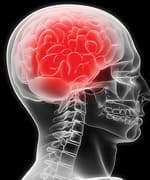 Vitamin B12 and Folic Acid Improve Memory in Two Year Trial