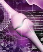 WHAT YOU NEED TO KNOW: Control Joint Inflammation with Curcumin