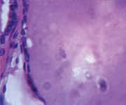 The Thyroid: What, Where, and How 