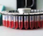 Consequences of Post-meal Glucose Surge