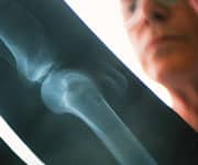 Complete Relief - Without a Potentially Life-Threatening Procedure