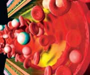 Attack Atherosclerosis