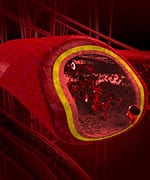 Preventing Glucose-Induced Cardiovascular Damage