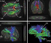 Dr. Gordon's Epiphany