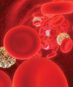 Taurine Protects Against Coronary Heart Disease in Women with High Cholesterol