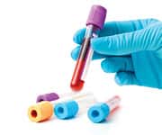 How This Study Compares to Life Extension’s Protocol