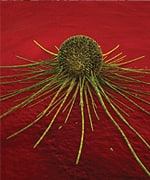 11. Nutrients that Prevent Tumors from Spreading