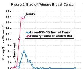 Figure 2 Size of Primary Breast Cancer