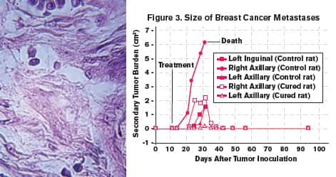 Figure 3 Size of Breast Cancer Metastases