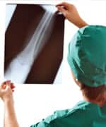 Help Prevent Osteoporosis