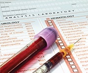 Results of Recent Survey of 25-hydroxyvitamin D Blood Tests