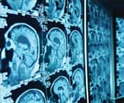 Cat screens on screens