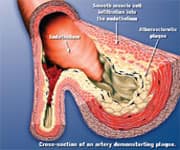 Anatomy of the Artery