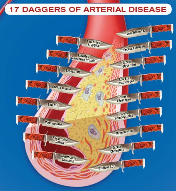 17 Daggers of arterial Disease