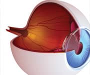 High Homocysteine, Low Folate, and B12 Predict Macular Degeneration