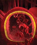 Endothelial Function and Your Health