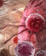 Prostate Cancer: Food For Thought