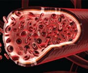 B Vitamin Supplementation Could Lower Stroke Risk