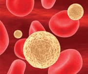 Trial Finds Benefit for Lycopene and Lutein in Adults with Subclinical Atherosclerosis