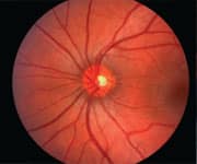 Reduced Urinary Magnesium Levels Linked to Elevated Ischemic Heart Disease Risk