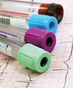 Mediterranean Diet Lowers Cardiovascular Events in Clinical Trial