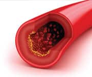 Reduced Urinary Magnesium Levels Linked to Elevated Ischemic Heart Disease Risk