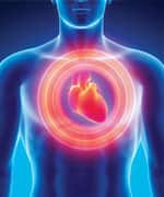 Heart attack concept