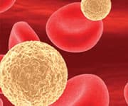 Pre-Op Fatty Acids, Antioxidants Help Prevent Post-Operative Atrial Fibrillation