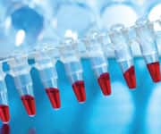 How DHA Controls Inflammation