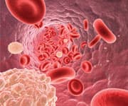 North Americans Deficient in Omega-3 