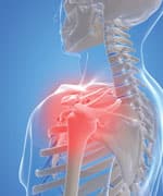 Novel Mechanism Protects Against Arthritis