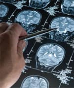 Melatonin: The Brain Hormone