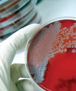 Factors Behind Gut Imbalance