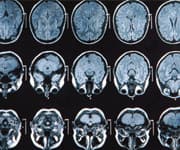 How Green Tea Protects The Brain