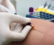 Glucosamine Extends Life Span In Mice