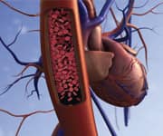 Compound Extends Life In Mouse Model Of Accelerated Aging