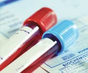 Higher Vitamin D Levels May Increase Survival Rates For Breast, Lymphoma, And Colon Cancer Patients