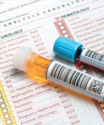 Magnesium Impacts Life Span