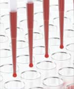 Chlorophyllin’s Anticancer Powers