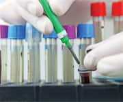 Why Most of Us Have Too Much Glucose