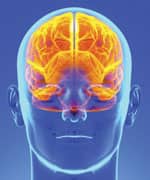 Minimize Migraine Attacks