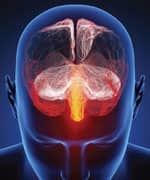 How Anti-Epileptic Drugs Mitigate Migraines